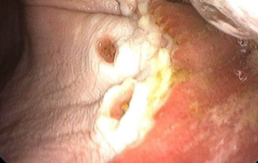 Why Horses With Ulcers Often Have Skin Problems — The Gut–Skin–Joint Connection